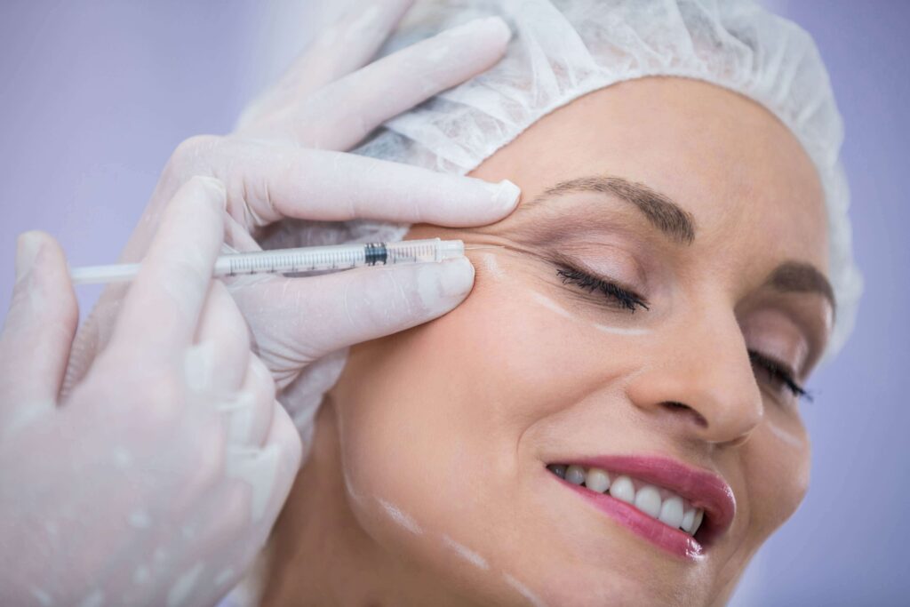 Bioestimuladores - Sculptra e Radiesse